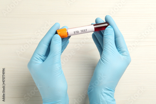 Scientist holding tube with blood sample and label STD Test at white table, top view