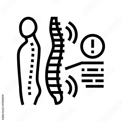 spondyloarthropathies health problem line icon vector. spondyloarthropathies health problem sign. isolated contour symbol black illustration