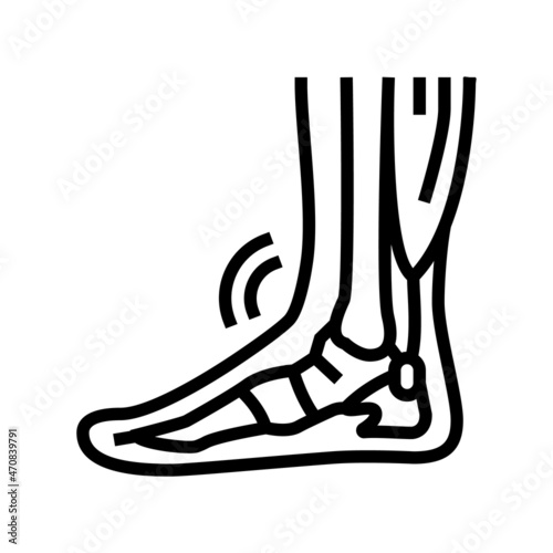 tendonitis problem line icon vector. tendonitis problem sign. isolated contour symbol black illustration