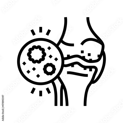 infectious arthritis line icon vector. infectious arthritis sign. isolated contour symbol black illustration
