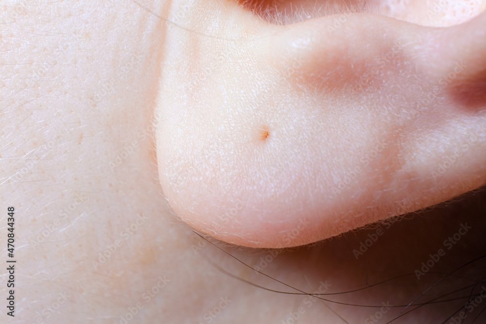 Fototapeta premium A close-up of the human earlobe. Macro photo of a pierced ear in a woman