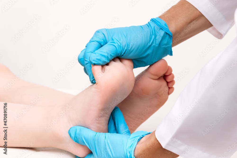 Examination of a child by an orthopedist. Close-up of female doctor's hands in blue medical gloves holding a kid's foot. Pathology of bone structures, flat feet, injury. Foot treatment - obrazy, fototapety, plakaty 