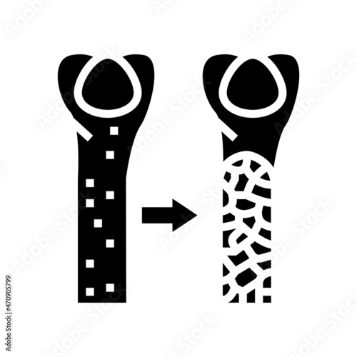 osteoporosis bone disease glyph icon vector. osteoporosis bone disease sign. isolated contour symbol black illustration