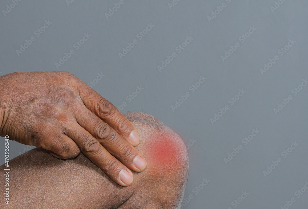Fototapeta premium knee pain problem after doing sport activities stock photo