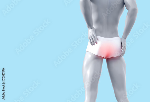 3d render illustration of male figure with highligthed haemorrhoids problem. photo