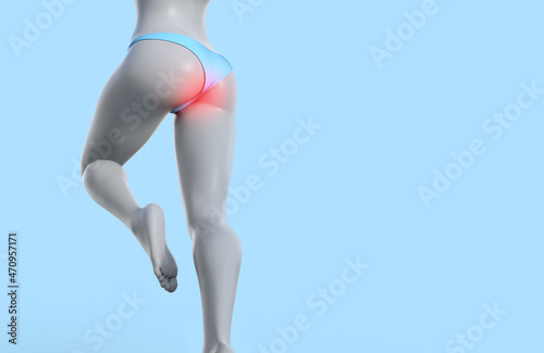 3d render illustration of female figure with highligthed haemorrhoids problem. photo