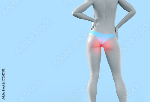 3d render illustration of female figure with highligthed haemorrhoids problem. photo