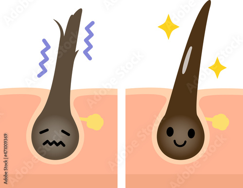 傷んだ髪と健康な髪のキャラクター