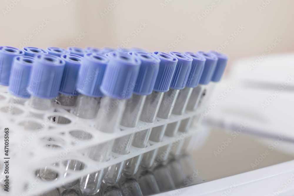 Test tube for analysis in the lab or manipulation room Test tube for analysis in the lab or manipulation room