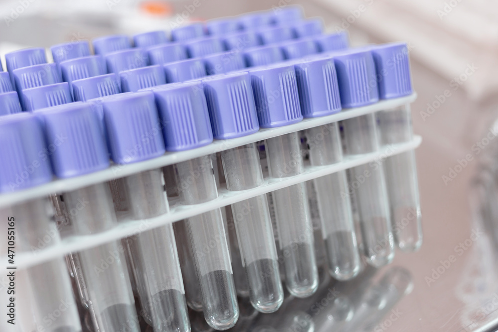 Test tube for analysis in the lab or manipulation room Test tube for analysis in the lab or manipulation room