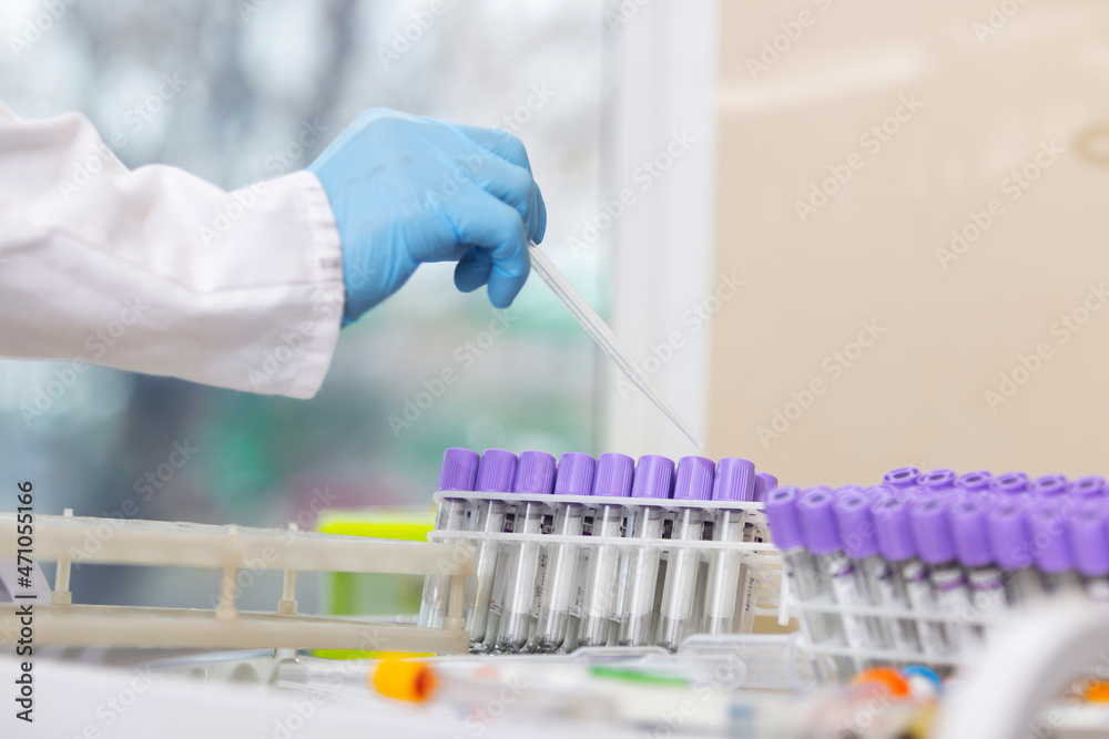 Test tube in scientist hand in laboratory. Doctor in uniform working with test tube for analysis in the lab. Test tube in scientist hand in laboratory. Doctor in uniform working with test tube for analysis in the lab.