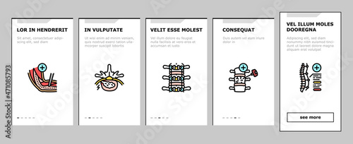 Neurosurgery Medical Treatment Onboarding Mobile App Page Screen Vector. Stereotactic Radiosurgery And Pediatric Neurosurgery, Neuro-oncology Researching, Coil Embolization Surgery. Illustrations