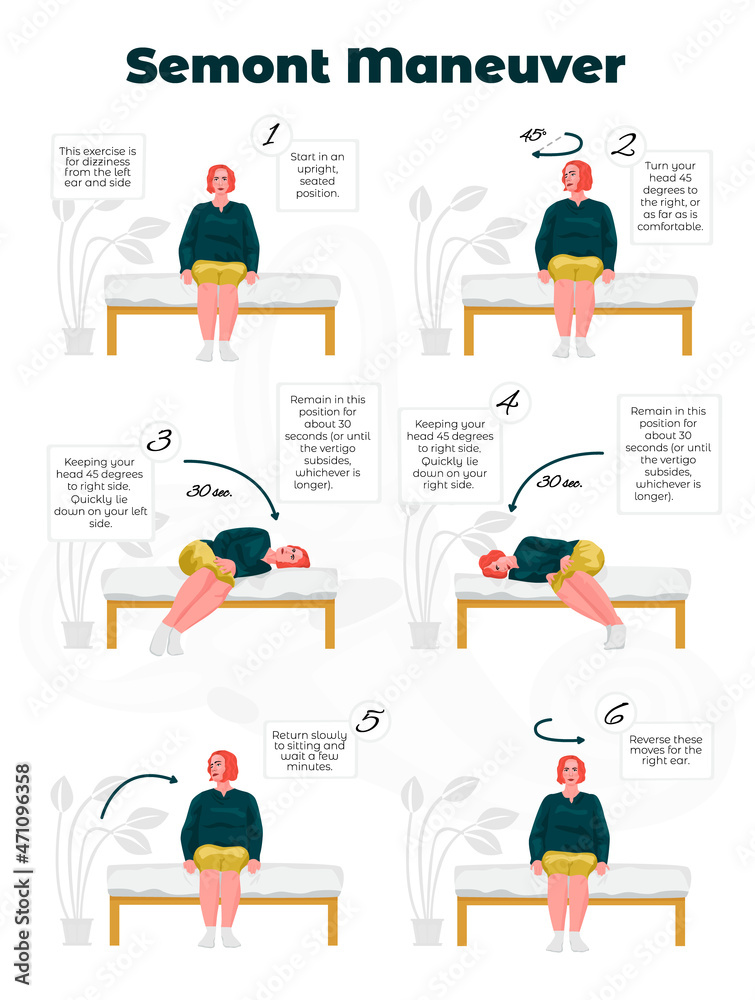 Vector image of an Exercise with Steps by Semont for Treatment of