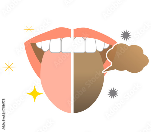 Bad breath and tongue stains Oral care illustrations.