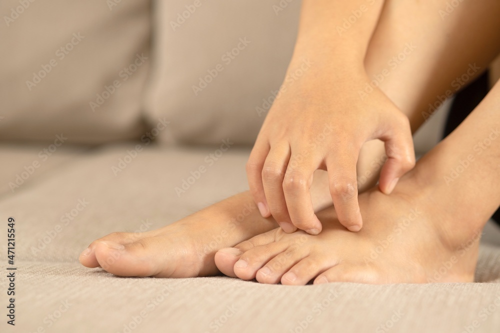 Foot fungus is caused by a multitude of fungal infections on the skin. Foot fungus is caused by a multitude of fungal infections on the skin.