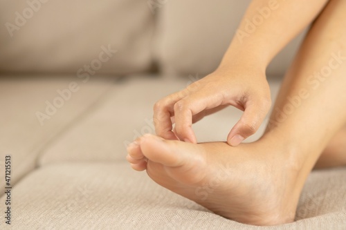 Hong Kong feet or water bite feet is a fungal infection of the feet and crotch of the toes because the area is damp