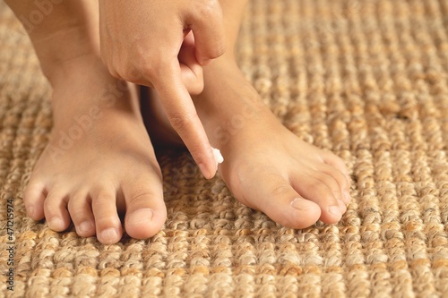 Obraz na plátně Fungal foot infections can be noticed for unusual symptoms such as itchy feet, or if the skin is red for no apparent reason