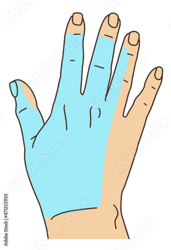 Radial nerve tunnel syndrome. Flat design line drawing of affected area sketch doodle style. Vector illustration