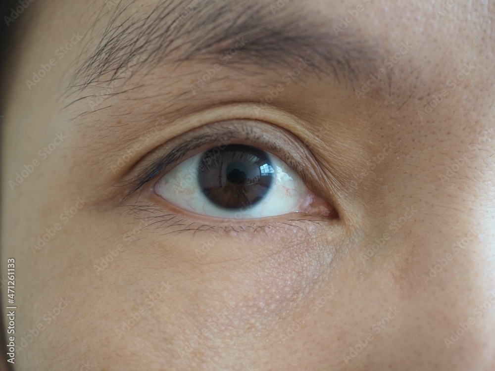 Obraz premium Young woman is squinting, strabismus concept. closeup photo, blurred.