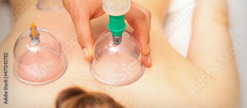 Woman receiving vacuum cupping treatment on back laying on the chest in massage salon
