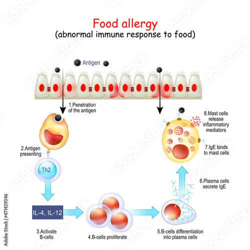 Food allergy. abnormal immune response to food. photo