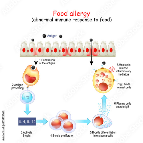 Food allergy. abnormal immune response to food.
