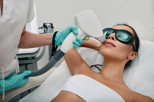 Brunette woman getting laser hair removal on her face, laser epilation to lips area. Facial laser hair removal photo