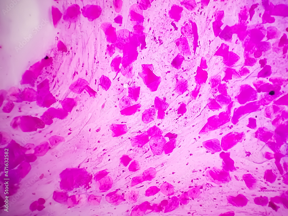 Gram stain Gram positive cocci, Gram positive diplococci bacteria
