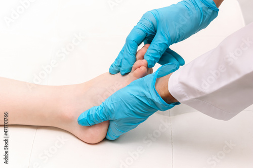 Examination of the child s feet by an orthopedist. Cropped shot of doctor in blue medical gloves holding a kid s foot in her hands. Pathology of bone structures  flat feet  injury. Foot treatment