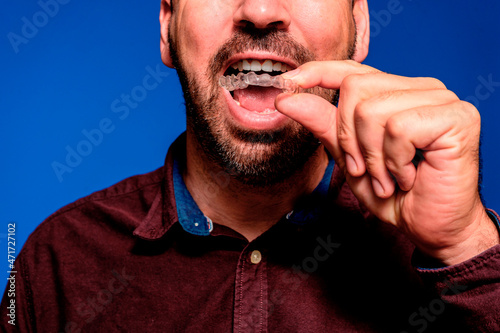 Young handsome Caucasian man, against blue wall holding a removable invisible aligner