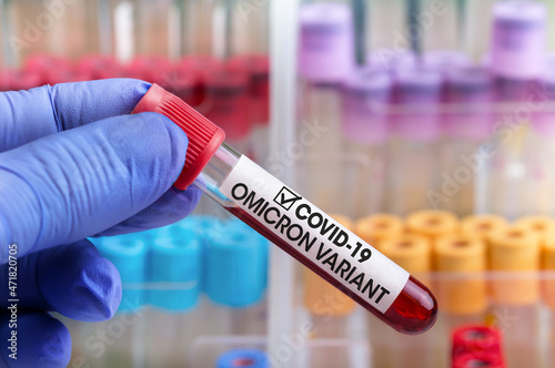 Leinwand Poster Doctor with blood sample of New Variant of Covid-19 Omicron B