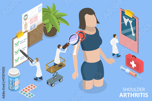 3D Isometric Flat Vector Conceptual Illustration of Shoulder Arthritis, Diagnosis and Treatment of Joint Inflammation photo
