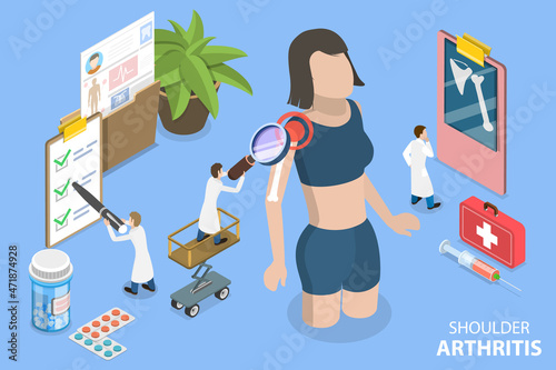 3D Isometric Flat Vector Conceptual Illustration of Shoulder Arthritis, Diagnosis and Treatment of Joint Inflammation