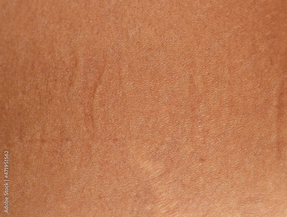 custom made wallpaper toronto digitaltan on the skin as a background