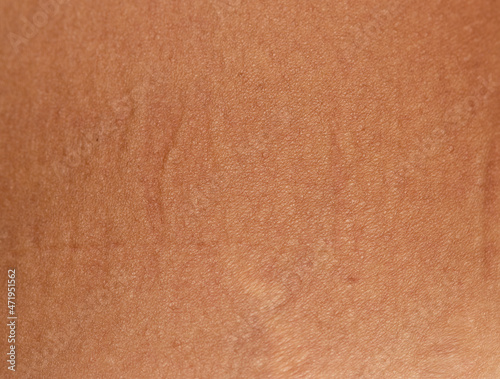 Wallpaper Mural tan on the skin as a background Torontodigital.ca