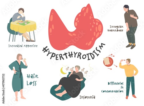 Hyperthyroidism symptoms, thyroid gland disease. Hyperthyreosis signs, endocrine system disorder. Vector illustration photo