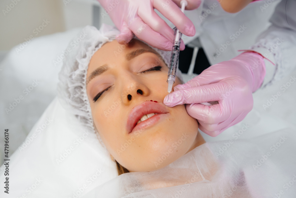 Cosmetology procedure for lip augmentation and wrinkle removal for a young beautiful girl. Cosmetology Cosmetology procedure for lip augmentation and wrinkle removal for a young beautiful girl. Cosmetology