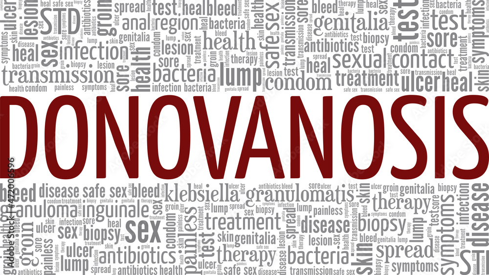 Donovanosis - Granuloma Inguinale vector illustration word cloud isolated on white background.
