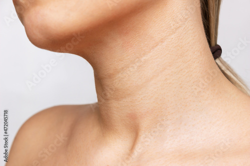 A close-up view of a young woman's neck isolated on a white background. Lines on the neck. Wrinkles, age-related changes, rings of Venus, goosebumps photo
