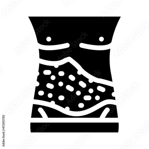 shingles skin disease glyph icon vector. shingles skin disease sign. isolated contour symbol black illustration