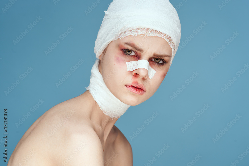 female patient plastic surgery operation bare shoulders studio lifestyle female patient plastic surgery operation bare shoulders studio lifestyle