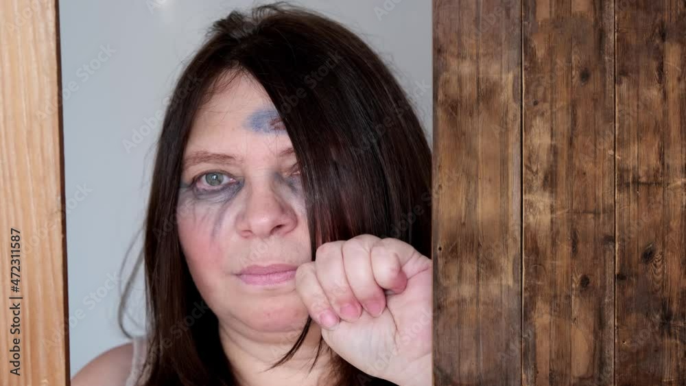 close-up of female tear-stained face, beaten woman with bruises and abrasions, quiet cry for help, concept of domestic violence, emotion of suffering from pain, kidnapping, being in danger close-up of female tear-stained face, beaten woman with bruises and abrasions, quiet cry for help, concept of domestic violence, emotion of suffering from pain, kidnapping, being in danger