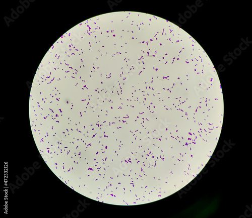Bacteria Enterococcus isolated on white background micrograph. Gram-positive cocci which cause infant endocarditis and other infections photo