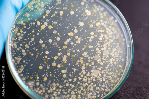 Backgrounds of Characteristics and Different shaped Colony of Bacteria and Mold growing on agar plates from Soil samples for education in Microbiology laboratory. 