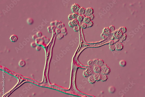 Microscopic fungi Cunninghamella, scientific 3D illustration. Pathogenic fungi from the order Mucorales, cause sinopulmonary and disseminated infections photo