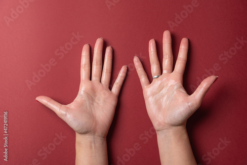 Open and wet woman hands with alcohol gel