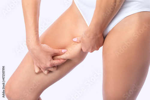 The girl stretches the skin on the leg, showing fat deposits. Treatment and getting rid of excess weight, the deposition of subcutaneous fat.
