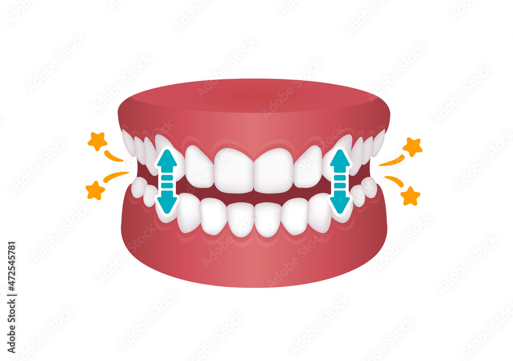 Bruxism vector illustration | tapping teeth Bruxism vector illustration | tapping teeth