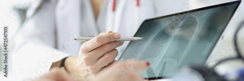 Doctor shows patient an x-ray of lungs on tablet closeup