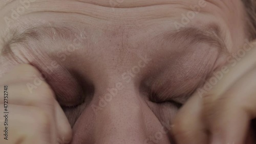 a man rubs his tired eyes with his hands, a speck in his eye, macro photo